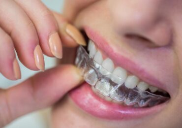 Clear Aligners In Yuma