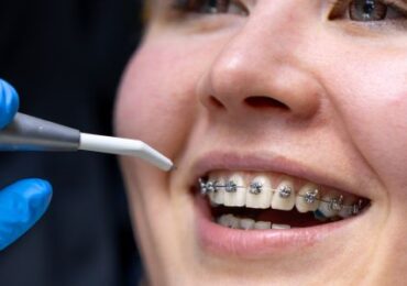 Traditional Braces In Yuma: Your Path to a Beautiful Smile