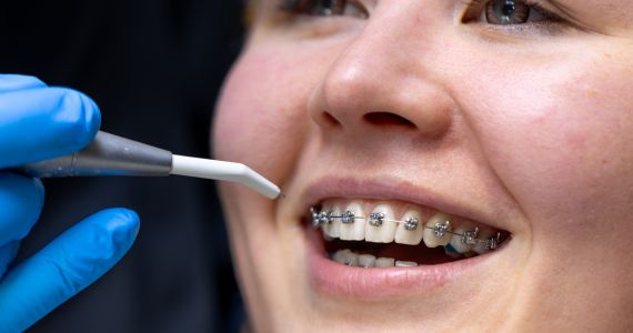 Traditional Braces In Yuma: Your Path to a Beautiful Smile