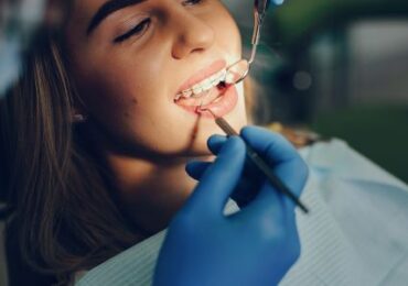 Dental Crowns and Bridges