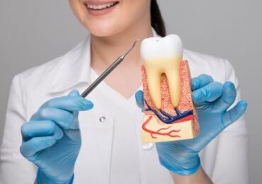 Root Canals Yuma