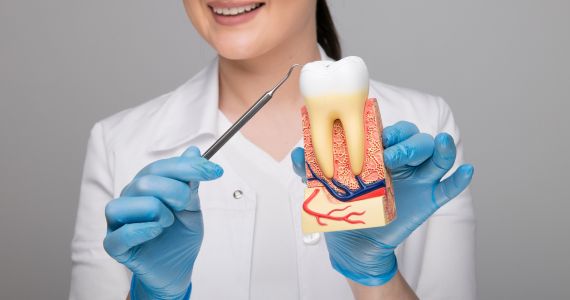 Root Canals Yuma