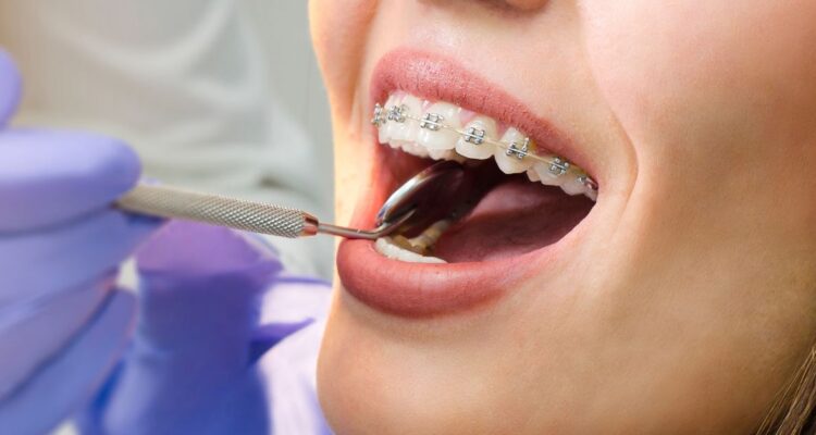 orthodontist merrillville