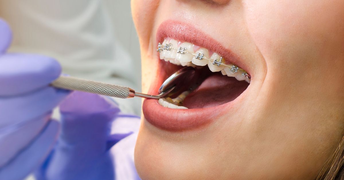 orthodontist merrillville