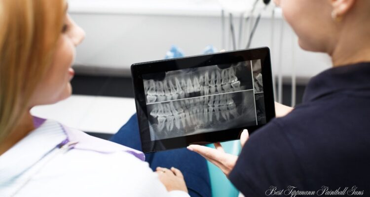 crown lengthening dental code