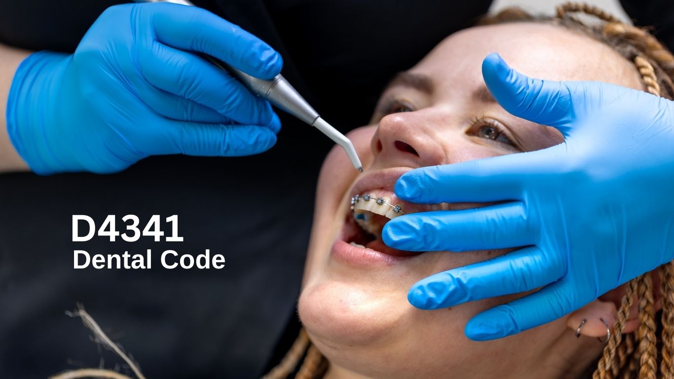 dental code 4341