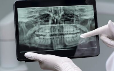 Can I Refuse Dental X-rays