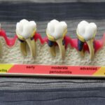 Dental Flipper Code