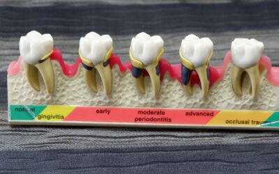 Dental Flipper Code