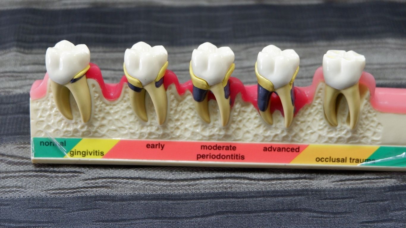 Dental Flipper Code